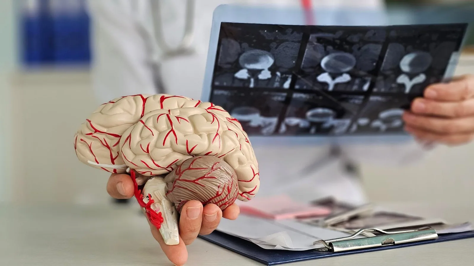 Enfermedad de Parkinson: Atención especializada en Cancún